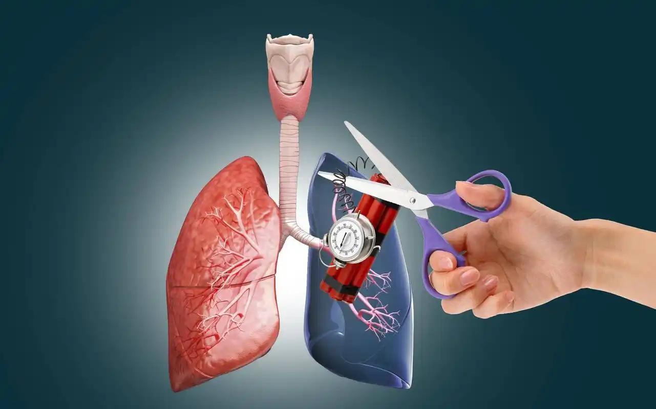 必发彩票app下载链接在哪-女子因肺栓塞不幸走了！医生：天冷宁愿躺一天，也别干这5事！